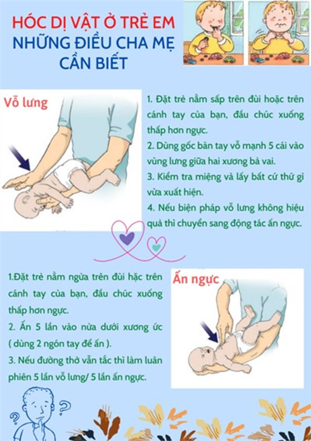 CÁCH XỬ TRÍ KHI TRẺ BỊ HÓC DỊ VẬT